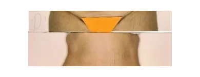 77 üzleti kép ZSÍRLESZÍVÁS KLINIKA DR LÁNYI CECÍLIA Plasztikai sebészet ban/ben Budapest