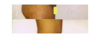 78 üzleti kép ZSÍRLESZÍVÁS KLINIKA DR LÁNYI CECÍLIA Plasztikai sebészet ban/ben Budapest