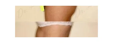 79 üzleti kép ZSÍRLESZÍVÁS KLINIKA DR LÁNYI CECÍLIA Plasztikai sebészet ban/ben Budapest