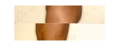 82 üzleti kép ZSÍRLESZÍVÁS KLINIKA DR LÁNYI CECÍLIA Plasztikai sebészet ban/ben Budapest