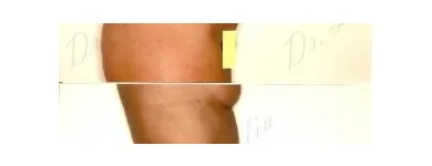 83 üzleti kép ZSÍRLESZÍVÁS KLINIKA DR LÁNYI CECÍLIA Plasztikai sebészet ban/ben Budapest