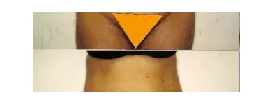 84 üzleti kép ZSÍRLESZÍVÁS KLINIKA DR LÁNYI CECÍLIA Plasztikai sebészet ban/ben Budapest