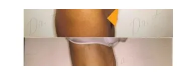 87 üzleti kép ZSÍRLESZÍVÁS KLINIKA DR LÁNYI CECÍLIA Plasztikai sebészet ban/ben Budapest