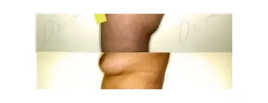 88 üzleti kép ZSÍRLESZÍVÁS KLINIKA DR LÁNYI CECÍLIA Plasztikai sebészet ban/ben Budapest