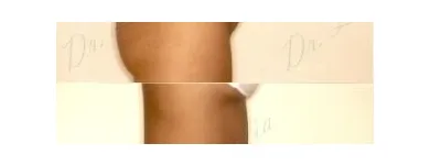 89 üzleti kép ZSÍRLESZÍVÁS KLINIKA DR LÁNYI CECÍLIA Plasztikai sebészet ban/ben Budapest