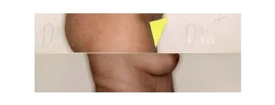 90 üzleti kép ZSÍRLESZÍVÁS KLINIKA DR LÁNYI CECÍLIA Plasztikai sebészet ban/ben Budapest