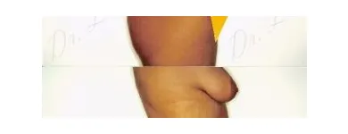 91 üzleti kép ZSÍRLESZÍVÁS KLINIKA DR LÁNYI CECÍLIA Plasztikai sebészet ban/ben Budapest