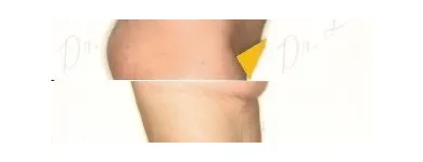 92 üzleti kép ZSÍRLESZÍVÁS KLINIKA DR LÁNYI CECÍLIA Plasztikai sebészet ban/ben Budapest