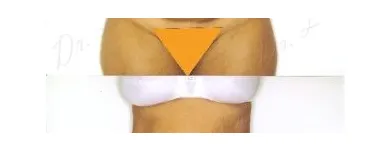 94 üzleti kép ZSÍRLESZÍVÁS KLINIKA DR LÁNYI CECÍLIA Plasztikai sebészet ban/ben Budapest