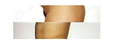 98 üzleti kép ZSÍRLESZÍVÁS KLINIKA DR LÁNYI CECÍLIA Plasztikai sebészet ban/ben Budapest