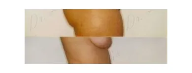 99 üzleti kép ZSÍRLESZÍVÁS KLINIKA DR LÁNYI CECÍLIA Plasztikai sebészet ban/ben Budapest