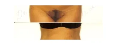 100 üzleti kép ZSÍRLESZÍVÁS KLINIKA DR LÁNYI CECÍLIA Plasztikai sebészet ban/ben Budapest