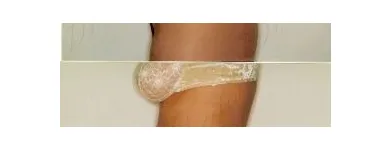 101 üzleti kép ZSÍRLESZÍVÁS KLINIKA DR LÁNYI CECÍLIA Plasztikai sebészet ban/ben Budapest