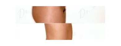 102 üzleti kép ZSÍRLESZÍVÁS KLINIKA DR LÁNYI CECÍLIA Plasztikai sebészet ban/ben Budapest