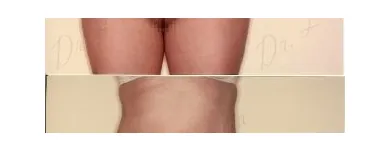 105 üzleti kép ZSÍRLESZÍVÁS KLINIKA DR LÁNYI CECÍLIA Plasztikai sebészet ban/ben Budapest