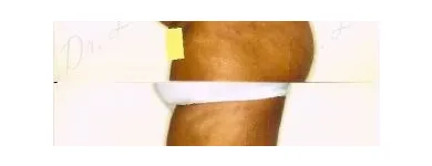 109 üzleti kép ZSÍRLESZÍVÁS KLINIKA DR LÁNYI CECÍLIA Plasztikai sebészet ban/ben Budapest