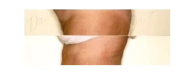 112 üzleti kép ZSÍRLESZÍVÁS KLINIKA DR LÁNYI CECÍLIA Plasztikai sebészet ban/ben Budapest