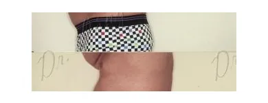 116 üzleti kép ZSÍRLESZÍVÁS KLINIKA DR LÁNYI CECÍLIA Plasztikai sebészet ban/ben Budapest