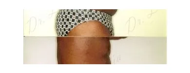 120 üzleti kép ZSÍRLESZÍVÁS KLINIKA DR LÁNYI CECÍLIA Plasztikai sebészet ban/ben Budapest