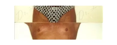 121 üzleti kép ZSÍRLESZÍVÁS KLINIKA DR LÁNYI CECÍLIA Plasztikai sebészet ban/ben Budapest