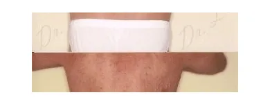 123 üzleti kép ZSÍRLESZÍVÁS KLINIKA DR LÁNYI CECÍLIA Plasztikai sebészet ban/ben Budapest