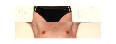 124 üzleti kép ZSÍRLESZÍVÁS KLINIKA DR LÁNYI CECÍLIA Plasztikai sebészet ban/ben Budapest