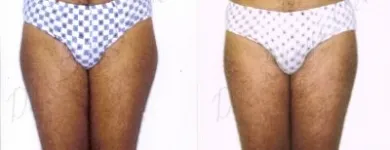 126 üzleti kép ZSÍRLESZÍVÁS KLINIKA DR LÁNYI CECÍLIA Plasztikai sebészet ban/ben Budapest