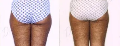 127 üzleti kép ZSÍRLESZÍVÁS KLINIKA DR LÁNYI CECÍLIA Plasztikai sebészet ban/ben Budapest