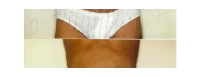 128 üzleti kép ZSÍRLESZÍVÁS KLINIKA DR LÁNYI CECÍLIA Plasztikai sebészet ban/ben Budapest