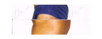 131 üzleti kép ZSÍRLESZÍVÁS KLINIKA DR LÁNYI CECÍLIA Plasztikai sebészet ban/ben Budapest