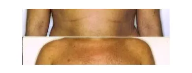 132 üzleti kép ZSÍRLESZÍVÁS KLINIKA DR LÁNYI CECÍLIA Plasztikai sebészet ban/ben Budapest