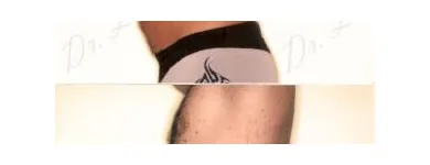 133 üzleti kép ZSÍRLESZÍVÁS KLINIKA DR LÁNYI CECÍLIA Plasztikai sebészet ban/ben Budapest