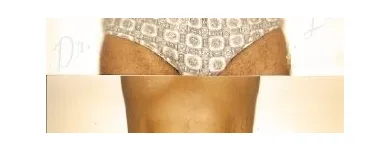 134 üzleti kép ZSÍRLESZÍVÁS KLINIKA DR LÁNYI CECÍLIA Plasztikai sebészet ban/ben Budapest