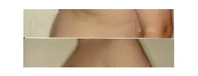 135 üzleti kép ZSÍRLESZÍVÁS KLINIKA DR LÁNYI CECÍLIA Plasztikai sebészet ban/ben Budapest