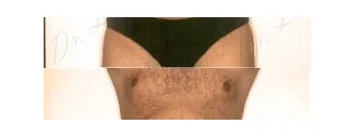 136 üzleti kép ZSÍRLESZÍVÁS KLINIKA DR LÁNYI CECÍLIA Plasztikai sebészet ban/ben Budapest