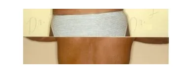 138 üzleti kép ZSÍRLESZÍVÁS KLINIKA DR LÁNYI CECÍLIA Plasztikai sebészet ban/ben Budapest