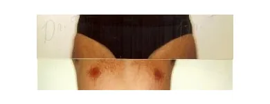 139 üzleti kép ZSÍRLESZÍVÁS KLINIKA DR LÁNYI CECÍLIA Plasztikai sebészet ban/ben Budapest