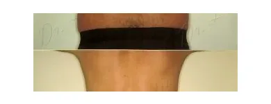 140 üzleti kép ZSÍRLESZÍVÁS KLINIKA DR LÁNYI CECÍLIA Plasztikai sebészet ban/ben Budapest