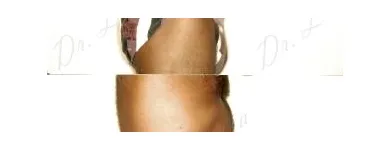 141 üzleti kép ZSÍRLESZÍVÁS KLINIKA DR LÁNYI CECÍLIA Plasztikai sebészet ban/ben Budapest