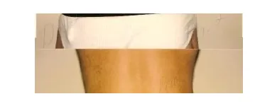 142 üzleti kép ZSÍRLESZÍVÁS KLINIKA DR LÁNYI CECÍLIA Plasztikai sebészet ban/ben Budapest