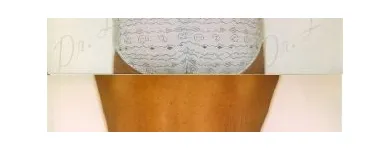 143 üzleti kép ZSÍRLESZÍVÁS KLINIKA DR LÁNYI CECÍLIA Plasztikai sebészet ban/ben Budapest