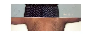 144 üzleti kép ZSÍRLESZÍVÁS KLINIKA DR LÁNYI CECÍLIA Plasztikai sebészet ban/ben Budapest