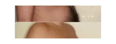 145 üzleti kép ZSÍRLESZÍVÁS KLINIKA DR LÁNYI CECÍLIA Plasztikai sebészet ban/ben Budapest