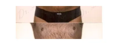 146 üzleti kép ZSÍRLESZÍVÁS KLINIKA DR LÁNYI CECÍLIA Plasztikai sebészet ban/ben Budapest