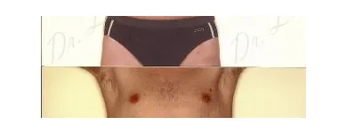 147 üzleti kép ZSÍRLESZÍVÁS KLINIKA DR LÁNYI CECÍLIA Plasztikai sebészet ban/ben Budapest