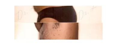 148 üzleti kép ZSÍRLESZÍVÁS KLINIKA DR LÁNYI CECÍLIA Plasztikai sebészet ban/ben Budapest