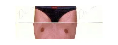 149 üzleti kép ZSÍRLESZÍVÁS KLINIKA DR LÁNYI CECÍLIA Plasztikai sebészet ban/ben Budapest