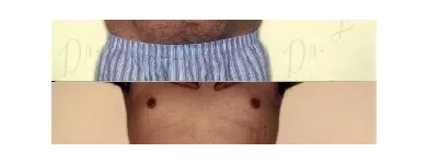 151 üzleti kép ZSÍRLESZÍVÁS KLINIKA DR LÁNYI CECÍLIA Plasztikai sebészet ban/ben Budapest