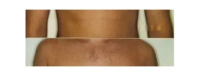 152 üzleti kép ZSÍRLESZÍVÁS KLINIKA DR LÁNYI CECÍLIA Plasztikai sebészet ban/ben Budapest