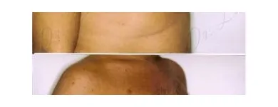 155 üzleti kép ZSÍRLESZÍVÁS KLINIKA DR LÁNYI CECÍLIA Plasztikai sebészet ban/ben Budapest